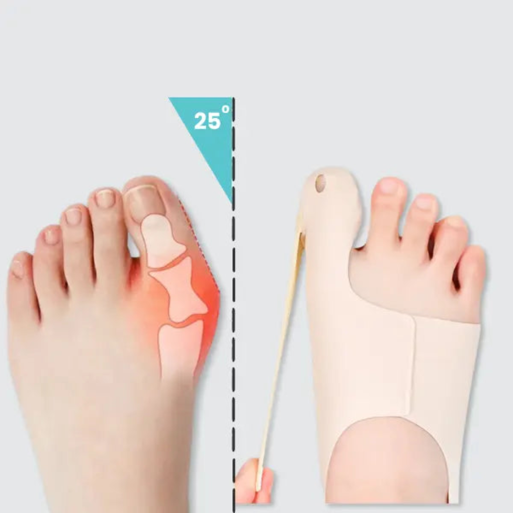 Manchon Correcteur Hallux