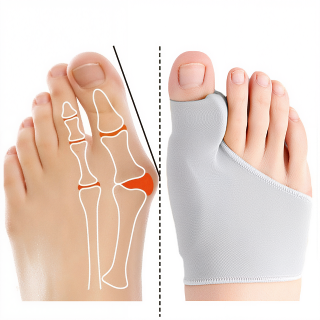 Séparateur d'Orteils avec Coussin en Gel pour Correction de Hallux Valgus